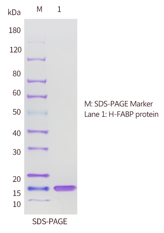 H-FABP抗原的SDS-PAGE分析图