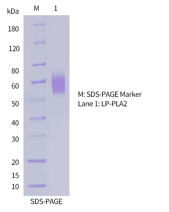 磷脂酶A2（Lp-PLA2）抗原SDS-PAGE图