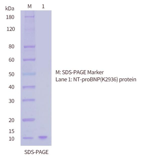 N端脑钠肽前体（NT-proBNP）抗原SDS-PAGE图