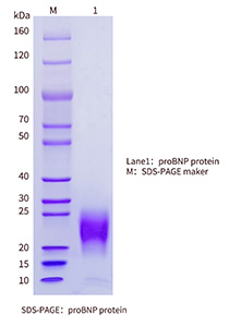 proBNP-SDS-PAGE